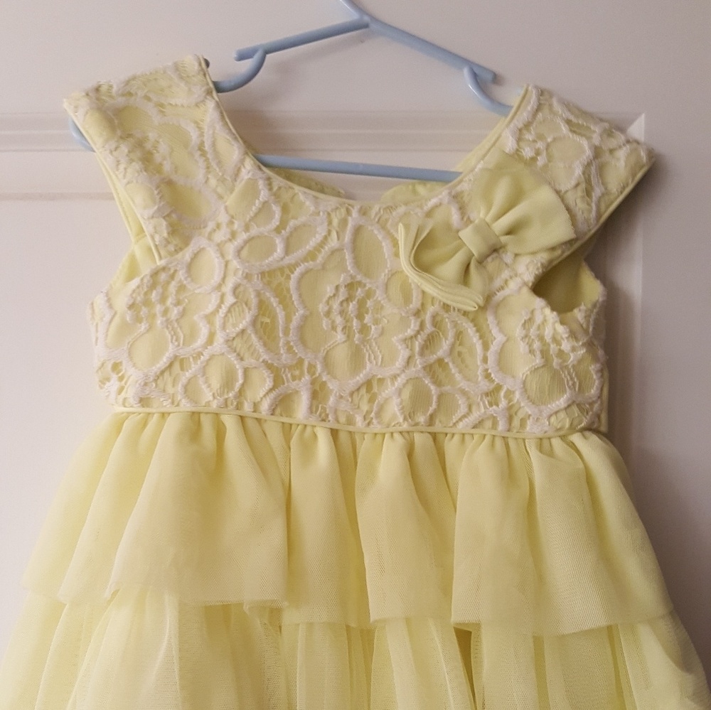 Yellow dress with lace.